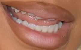 Picture of Saweetie teeth and smile
