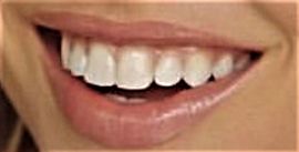 Picture of Shanna Moakler teeth and smile
