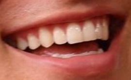 Shawn Mendes teeth and smile