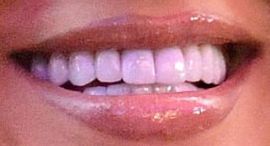 Picture of Shay Mitchell teeth and smile