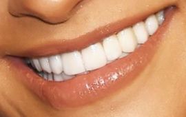 Picture of Shay Mitchell teeth and smile