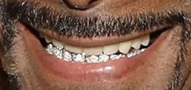 Picture of Snoop Dogg teeth and smile
