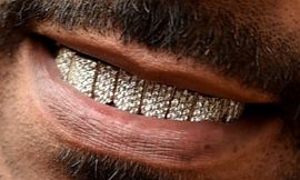 Picture of Snoop Dogg teeth and smile