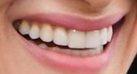 Picture of Sofia Boutella healthy teeth and smile