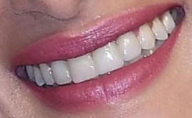 Picture of Sofia Boutella healthy teeth and smile
