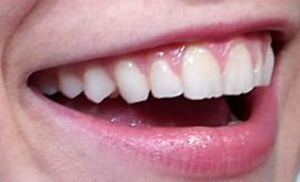 Picture of Sophia Lillis teeth and smile