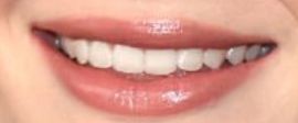 Picture of Sophie Turner teeth and smile