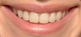 Picture of Suki Waterhouse teeth and smile