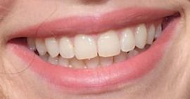 Picture of Suki Waterhouse teeth and smile