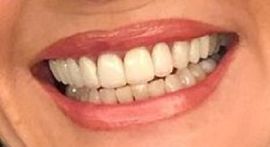 Picture of Susan Lucci teeth and smile