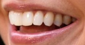 Picture of Sutton Foster teeth and smile