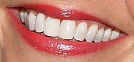 Picture of Sutton Foster teeth and smile