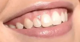 Picture of Sydney Sweeney teeth and smile