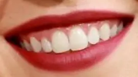Picture of Sydney Sweeney teeth and smile