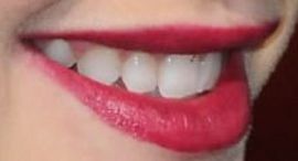 Picture of Talitha Bateman teeth and smile