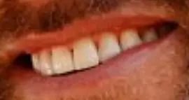 Picture of Tarek El Moussa teeth and smile