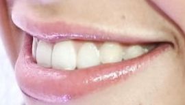 Picture of Tate McRae teeth and smile