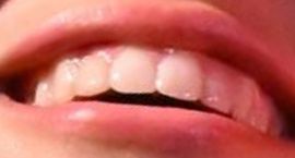 Picture of Tate McRae teeth and smile