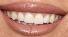 Picture of Teddi Mellencamp Arroyave teeth and smile
