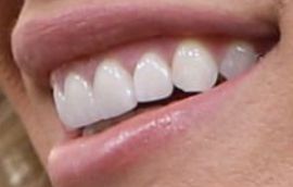 Picture of Teddi Mellencamp Arroyave teeth and smile