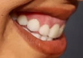Picture of Tessa Thompson teeth
