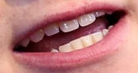 Picture of Tom Holland teeth and smile