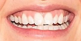 Picture of Tove Lo teeth and smile