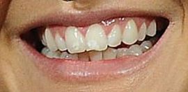 Picture of Tove Lo teeth and smile