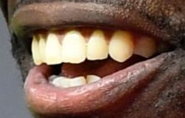 Picture of Tyreek Hill teeth and smile