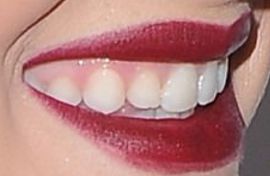 Picture of Willow Shields teeth and smile