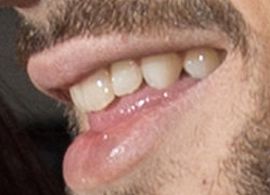 Picture of Zayn Malik teeth and smile