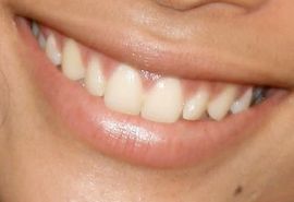 Picture of Zoe Kravitz teeth and smile