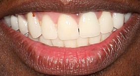 Picture of 50 Cent teeth and smile
