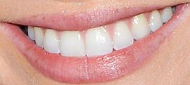 Picture of Abigail Cowen teeth and smile