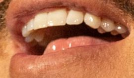 Picture of Adam Lambert teeth and smile