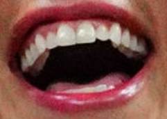 Picture of Adriana Lima's teeth
