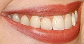 Picture of Adrienne Frantz teeth and smile