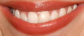 Picture of Adrienne Frantz teeth and smile