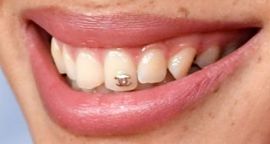 Picture of Adwoa Aboah teeth and smile
