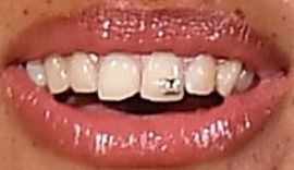 Picture of Adwoa Aboah teeth and smile