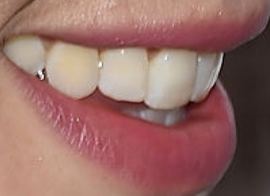 Picture of Agyness Deyn teeth and smile