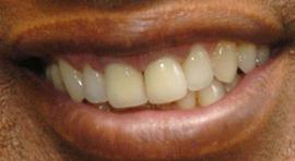Picture of Al Roker teeth and smile