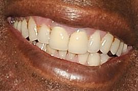 Picture of Al Roker teeth and smile