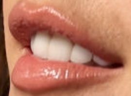 Picture of Alessandra Ambrosio teeth and smile