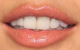 Picture of Alessandra Ambrosio teeth and smile