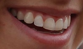 Picture of Alex Morgan teeth and smile