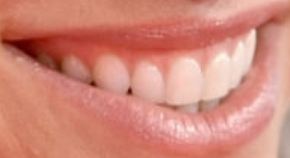 Picture of Alexa Bliss teeth and smile