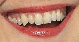 Picture of Alexandra Breckenridge teeth and smile