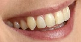 Picture of Alexandra Breckenridge teeth and smile