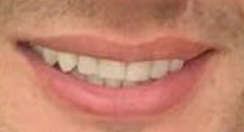 Picture of Alexei Brovarnik teeth and smile